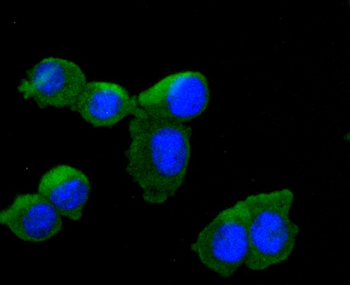 Tyrosine Hydroxylase Recombinant Rabbit Monoclonal Antibody
