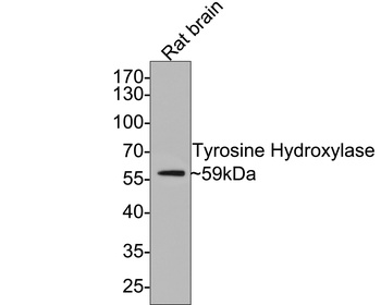 Tyrosine Hydroxylase antibody