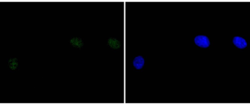 DNA PKcs Recombinant Rabbit Monoclonal Antibody