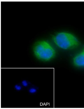 ARPC5 Recombinant Rabbit Monoclonal Antibody