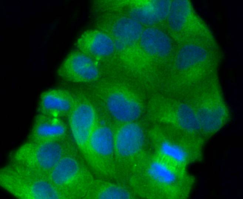 Beta Tubulin Recombinant Rabbit Monoclonal Antibody
