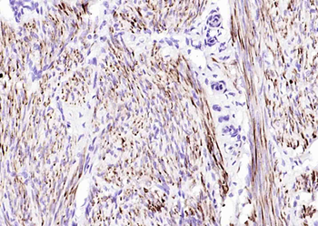 Desmin Mouse Monoclonal Antibody
