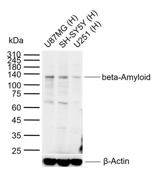 beta-Amyloid (1-40) antibody