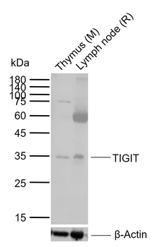 TIGIT Rabbit Polyclonal Antibody