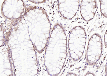 ASC/TMS1 Rabbit Polyclonal Antibody