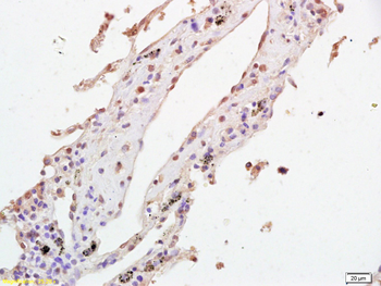 PITX2 Rabbit Polyclonal Antibody