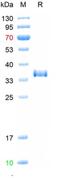 Recombinant SARS-CoV-2 (Omicron, B.1.1.529/BA.2 ) Spike RBD Protein (G339D、 S371F, S373P, S375F, T376A, D405N, R408S, K417N, N440K, S477N, T478K, E484A, Q493R, Q498R, N501Y, Y505H)