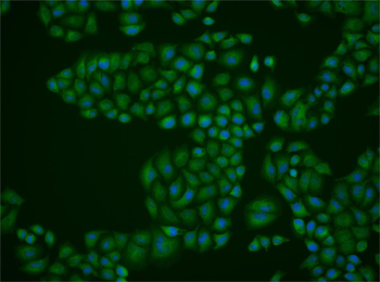 PIBF1 Rabbit Polyclonal Antibody