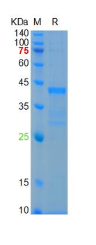 Recombinant mouse EAAT2 protein, GST & His
