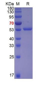 Recombinant EV71 polyprotein 3D protein, His