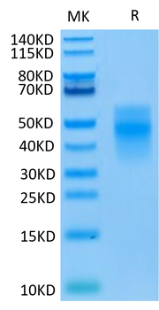 Recombinant human TREM1 protein, C-His (HEK293)