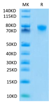 Recombinant human TNFR2 protein, C-mFc (HEK293)