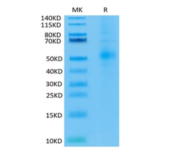 Recombinant human TGFBR1 protein, C-mFc-Avi (HEK293)