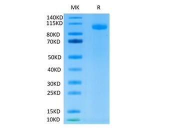 Recombinant human SIGLEC5 protein, C-hFc (HEK293)