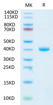 Recombinant human RSPO1 protein, C-His (HEK293)