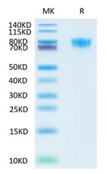 Recombinant human PDGFRA protein, C-His-Avi (HEK293)