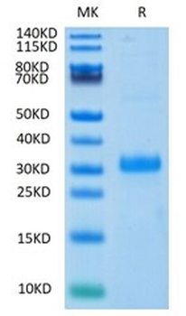Recombinant human Noggin (HEK293)