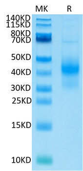 Recombinant human NKG2D protein, N-His-Avi (HEK293)