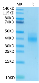 Recombinant human NKG2A & CD94 protein, N-His-Avi (HEK293)