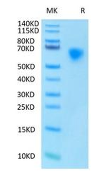 Recombinant human MICA protein, C-His-Avi (HEK293)