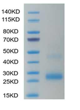 Recombinant human LIGHT protein, C-His (HEK293)