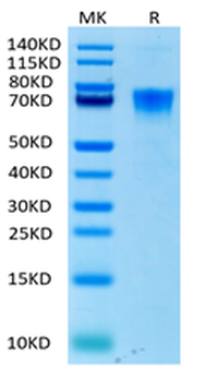Recombinant human IL-6R protein, C-His-Avi (HEK293)