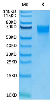 Recombinant human IL-17RA protein, C-His-Avi (HEK293)