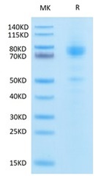 Recombinant human IL-13RA2 protein, C-hFc (HEK293)