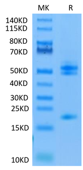 Recombinant human IL-23 Alpha & mouse IL-12 Beta protein, C-His-Avi (HEK293)
