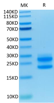 Recombinant mouse IL-17A protein, C-His-Avi (HEK293)