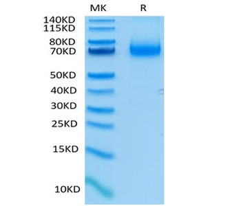 Recombinant human IL-7R Alpha / CD127 protein, C-hFc (HEK293)