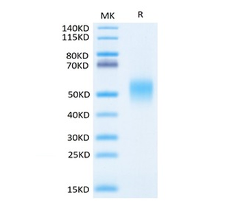 Recombinant human IL-7R Alpha / CD127 protein, C-His (HEK293)