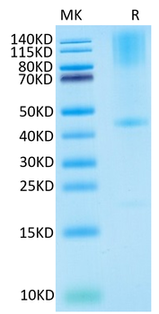 Recombinant human Glypican 3 protein, C-His (HEK293)