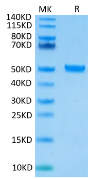 Recombinant human FcRn protein, C-His-Avi (HEK293)