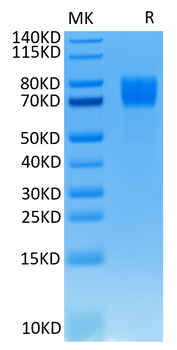 Recombinant human FGFR1 Alpha (IIIc) protein, C-His-Avi (HEK293)