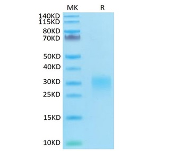 Recombinant human Fas Ligand protein, N-His (HEK293)