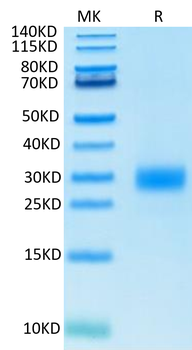 Recombinant human CTLA4 protein, C-His (HEK293)