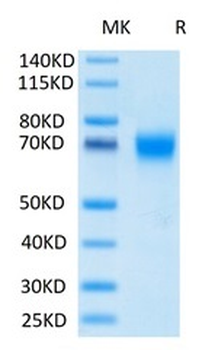 Recombinant human GM-CSF R Alpha protein, C-His-Avi (HEK293)