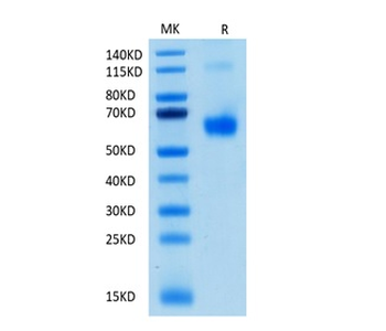 Recombinant human CD70 (Trimer) protein, N-His (HEK293)