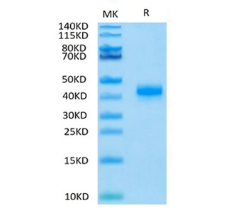 Recombinant human CD23 / Fc Epsilon RII protein, N-His (HEK293)