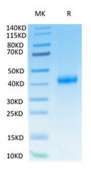 Recombinant human CD122 / IL2RB protein, C-His-Avi (HEK293)