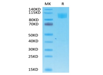 Recombinant Cyn. monkey ACE2 protein, C-His-Avi (HEK293)