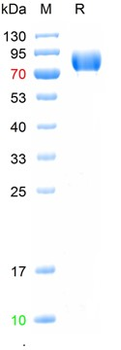 Recombinant human ACE2 protein, C-His (HEK293)