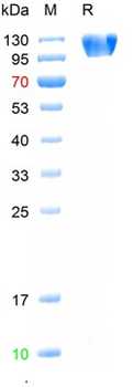 Recombinant human ACE2 protein, His & Avi (HEK293)