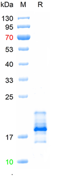 Recombinant human MCP-1 / CCL2 protein, C-His-Avi (HEK293)