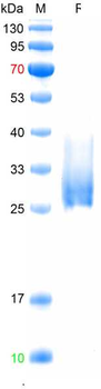 Recombinant human TGFBR2 protein, C-His (HEK293)