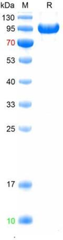 Recombinant human MMP9 protein, C-His (HEK293)