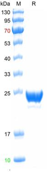 Recombinant human NGAL protein, His (HEK293)