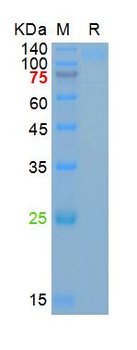 Recombinant SARS-Cov-2 Spike S1 protein (L18F, T20N, P26S, D138Y, R190S, K417T, E484K, N501Y, D614G, H655Y), His (HEK293)