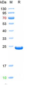 Recombinant human RBP4 protein, His (HEK293)